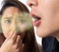 أسباب وعلاج رائحة الفم الكريهة
